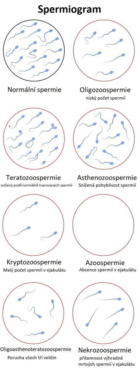 Infografika: Základné testy pri darovaní spermií