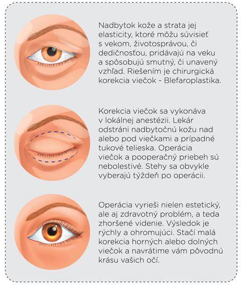 Infografika: anatomická anatómia očných viečok a mazových žliaz