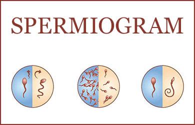 Infografika: čo je spermiogram a čo znamená jeho normy