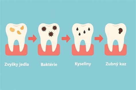 Dojčenie a zubný kaz: Mýty a fakty