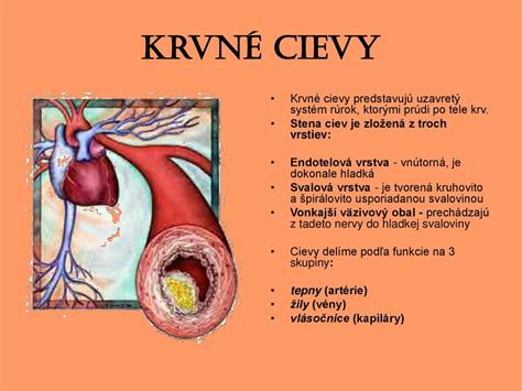 Ilustrácia upchatých ciev