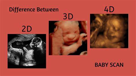 Infografika: 3D vs 4D ultrazvuk - rozdiel a časový rámec