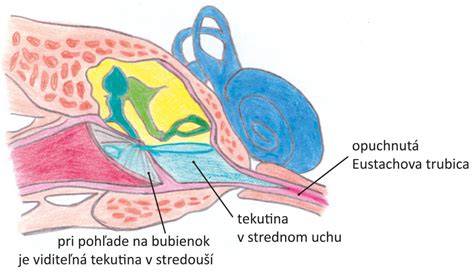 Infografika: Ako funguje Eustachova trubica a faktory ovplyvňujúce bolesť ucha