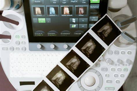 Infografika: Morfologický ultrazvuk - časový rámec a čo sa sleduje